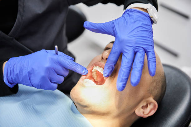 Best Emergency Wisdom Tooth Extraction in Effingham, IL